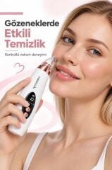 Torima Vakumlu Siyah Nokta Temizleme Aleti Akne Komedon Gözenek Bakımı Cilt Bakım Cihazı VR01 Beyaz