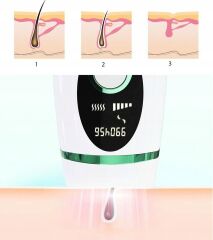 InFace IPL Epilation Device Green