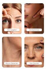 Ems Yüz ve Boyun Kırışıklık Bakım Destekli Gıdı ve Sarkma Önleyci Güzellik Cihazı ES1081 Beyaz